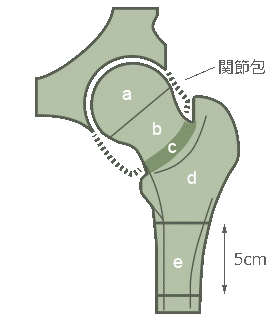 股関節の症状や痛みの原因 最新の手術法について医師が徹底解説 人工関節と脊椎手術なら横浜町田関節脊椎病院